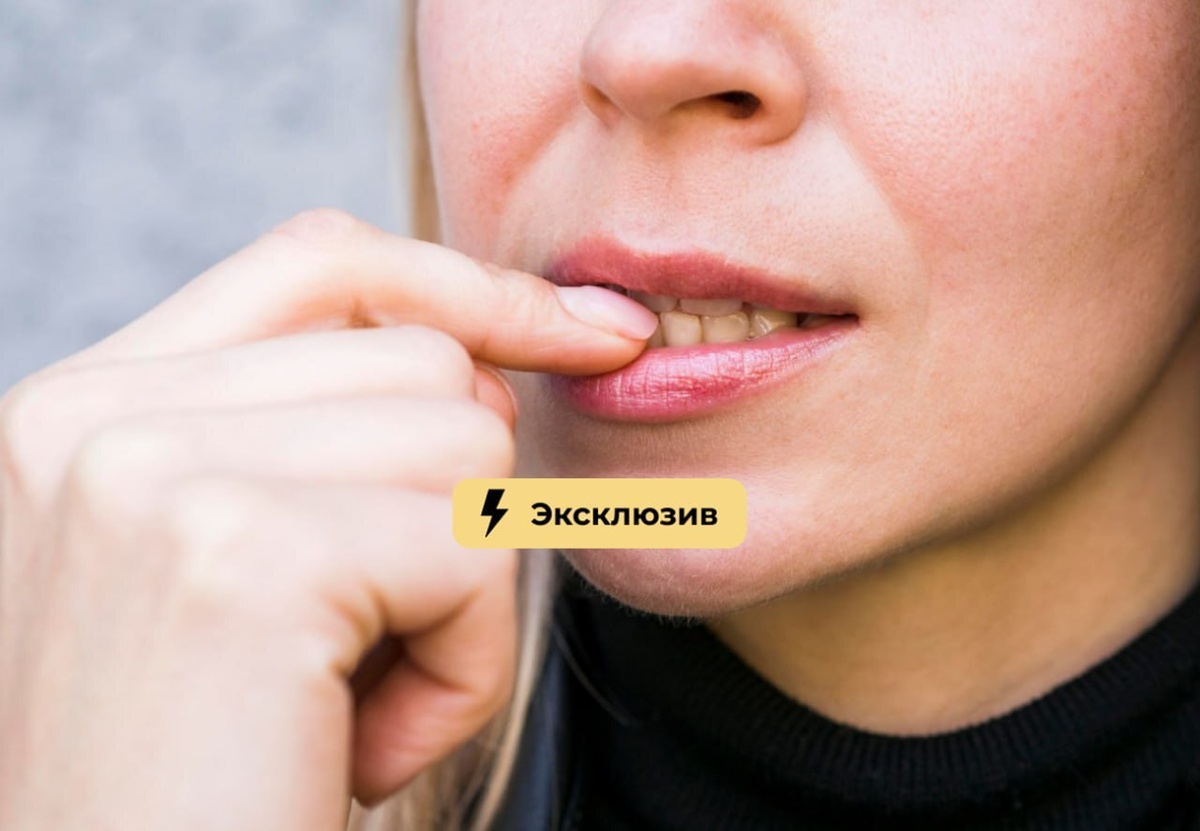 Борьба с зубным налётом: домашние методы, которые действительно работают