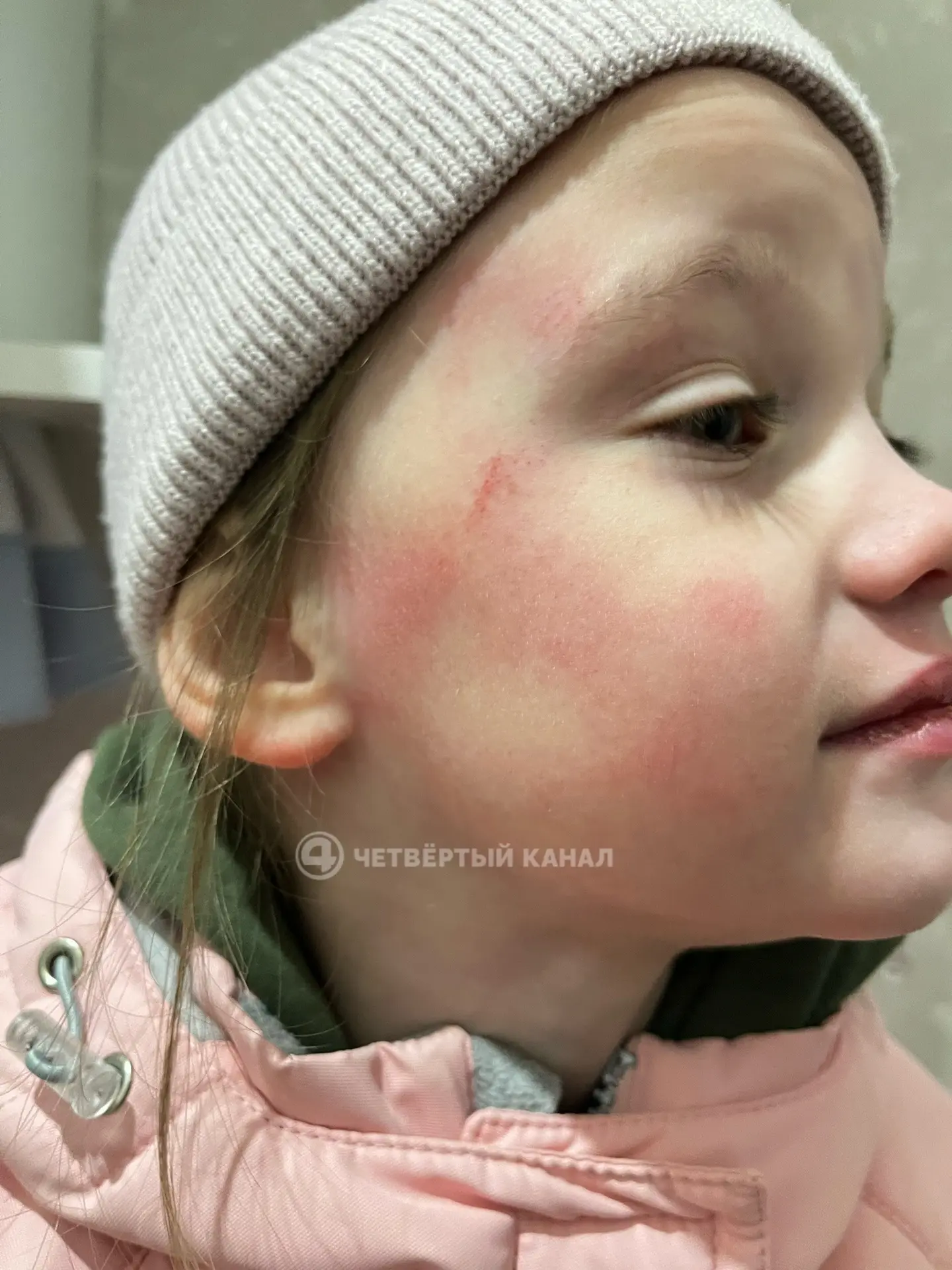 «Дочь стала неуравновешенной»: воспитатель, избивший ребёнка в Асбесте, продолжает работать в детском саду «Дочь стала неуравновешенной»: воспитатель, избивший ребёнка в Асбесте, продолжает работать в детском саду