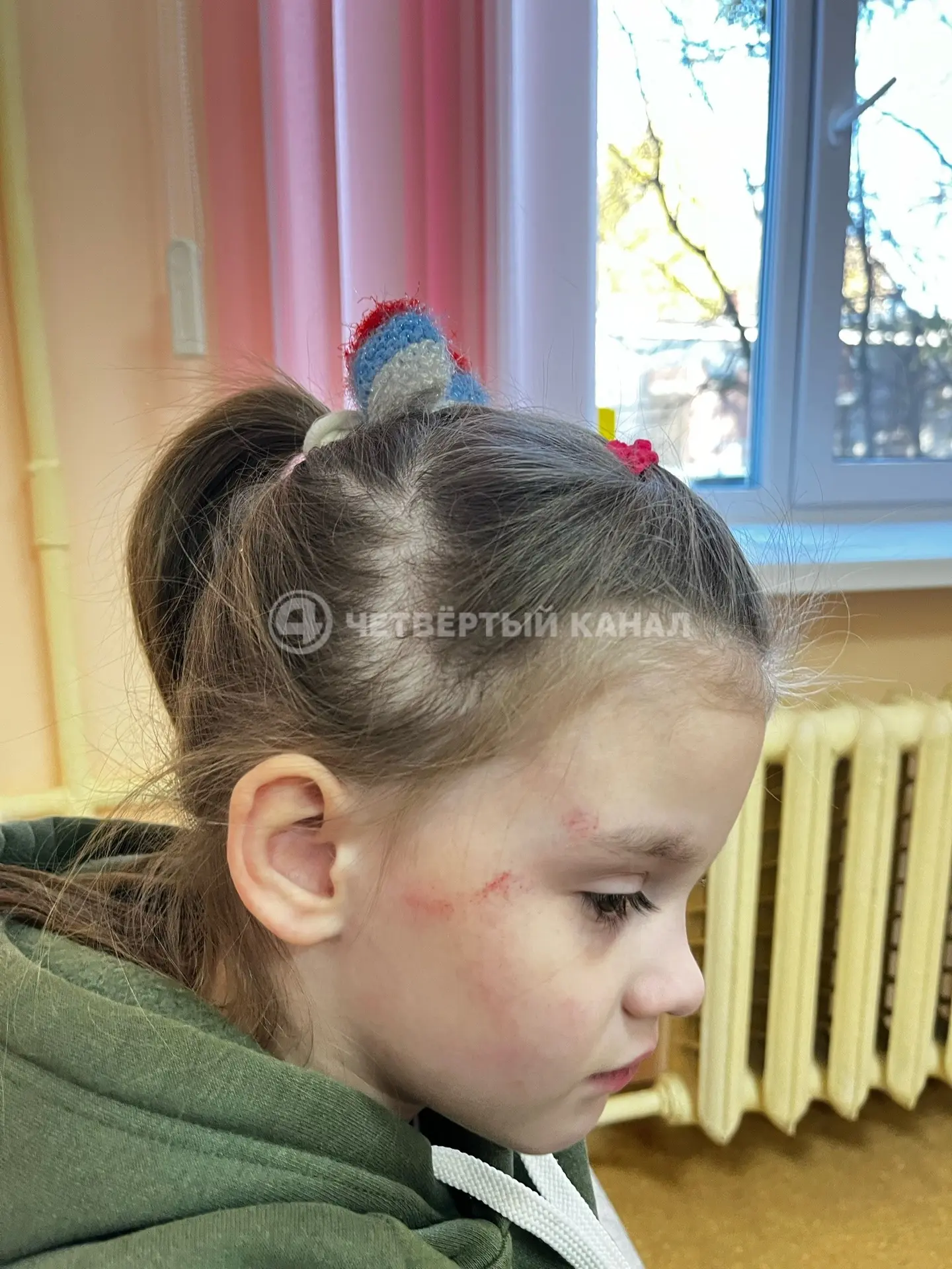 «Дочь стала неуравновешенной»: воспитатель, избивший ребёнка в Асбесте, продолжает работать в детском саду «Дочь стала неуравновешенной»: воспитатель, избивший ребёнка в Асбесте, продолжает работать в детском саду