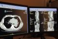 Свердловский хоккеист чуть не погиб после перелёта на самолёте из-за тромба в лёгких
