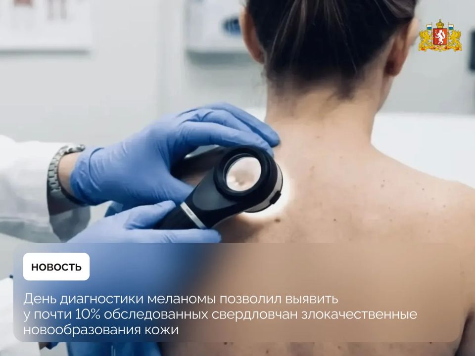 Забота о здоровье. Более 1,3 тысячи уральцев прошли обследование в единый день диагностики меланомы