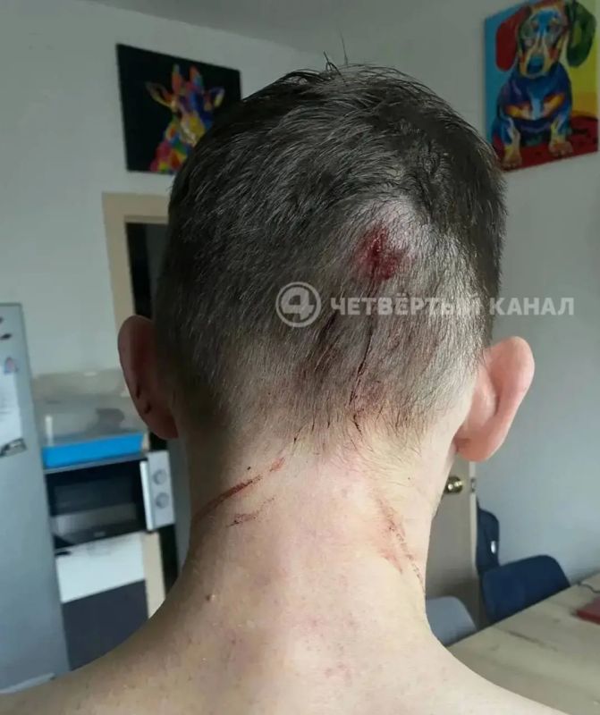 «Нас убивают около дома»: жители Академического рассказали о новом нападении у круглосуточного бара «Нас убивают около дома»: жители Академического рассказали о новом нападении у круглосуточного бара